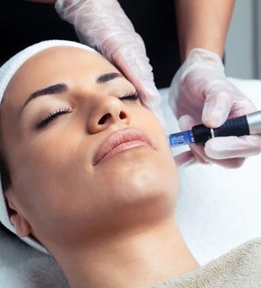 microneedling-mobile